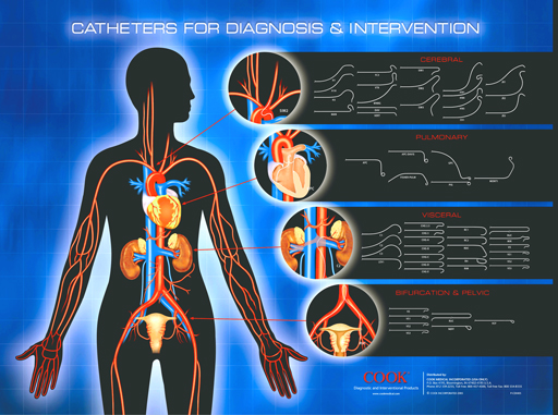 cathether for diagnostic